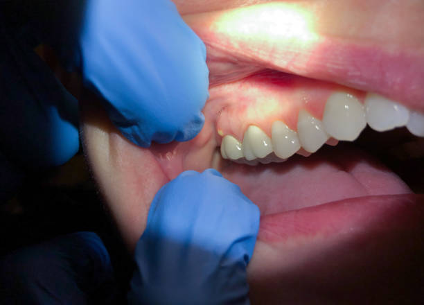 Best Urgent Dental Care  in Horse Pasture, VA