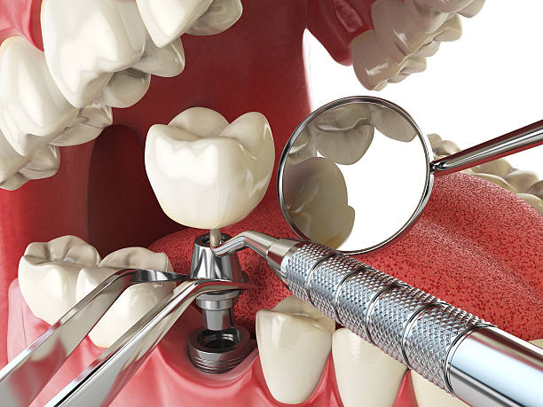 Best Cracked Tooth Emergency Dentist  in Horse Pasture, VA